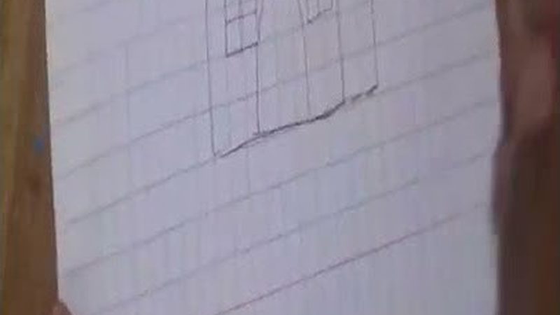牙齿缝隙大，矫正之外还有这些方法